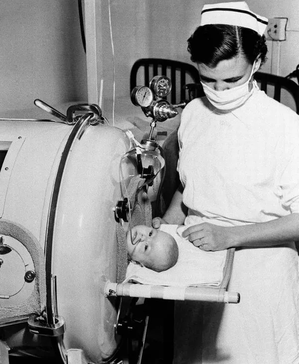 La pequeña Martha Ann Murray es vigilada por una enfermera en un pulmón de acero en 1952. AP Photo