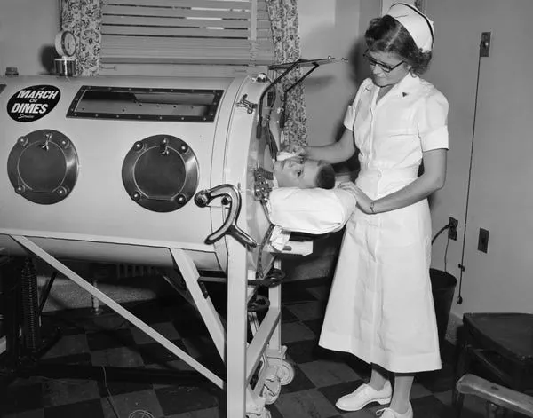 Una enfermera supervisa a un niño con polio en un pulmón de acero en 1955. Kirn Vintage Stock/Corbis/Getty Images